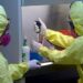 Perú declara alerta por la viruela del mono pese a no haber detectado casos