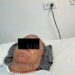 Operarán a César D. a corazón abierto en CDMX