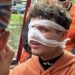 De fiesta en Amsterdam ¿Lando Norris se rompe la nariz?