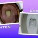 El truco con aluminio para acabar con el sarro del baño sin pasar horas tallando