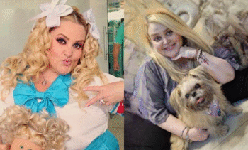 Perdió actriz Sheyla 50 kilos y donó su piel a niños quemados
