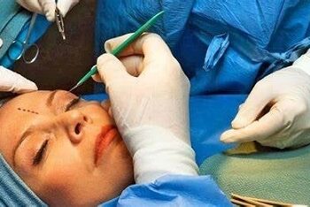 Continúa abierto Curso de Cirugía Estética de la UACh