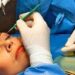 Continúa abierto Curso de Cirugía Estética de la UACh